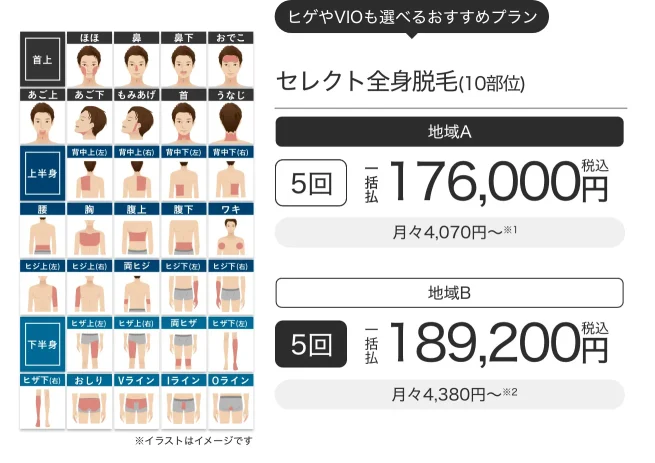 エミナルクリニックメンズライトプランセレクト全身脱毛