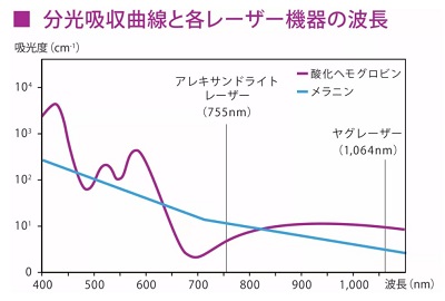 ジェントルマックスプロの波長