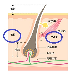 脱毛方式の種類