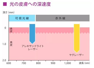 ジェントルマックスプロの光の深達度