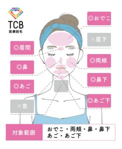 TCB顔脱毛範囲