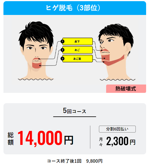 メンズリゼヒゲ３部位