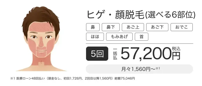 エミナルクリニックメンズヒゲ・顔脱毛選べる6部位