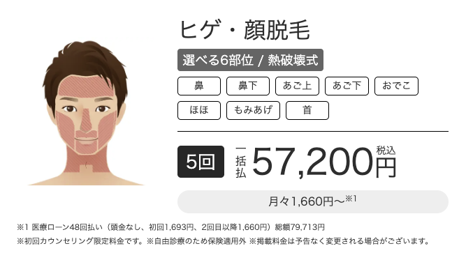 エミナルクリニックメンズヒゲ・顔脱毛選べる6部位