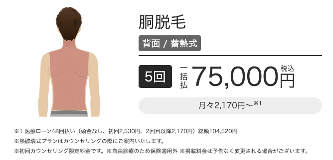 メンズエミナル胴脱毛背面