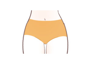 レジーナクリニックVIO脱毛