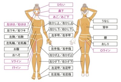 レジーナクリニック全身＋VIO＋顔脱毛範囲