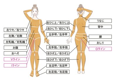 レジーナクリニック全身＋VIO脱毛範囲