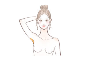 レジーナクリニック脇脱毛
