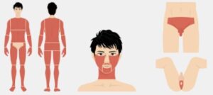 全身+VIO+ヒゲ脱毛