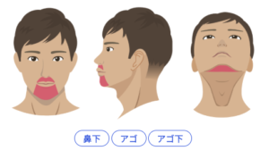 レジーナクリニックオムヒゲ脱毛3部位