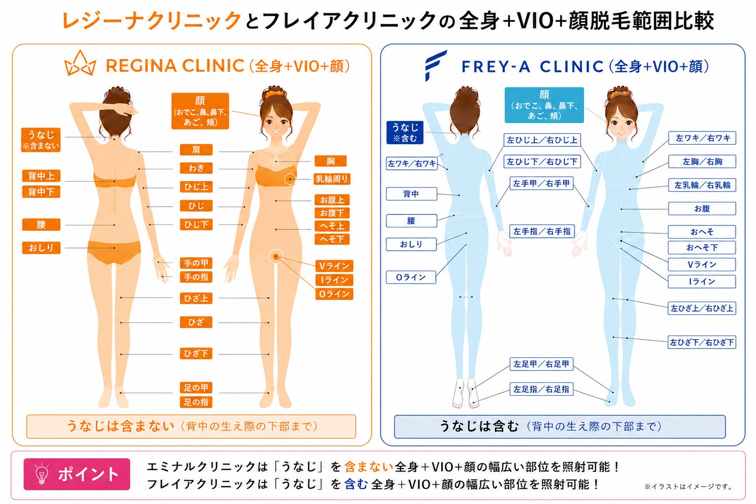 レジーナクリニックとフレイアクリニックの全身+VIO+顔脱毛範囲比較
