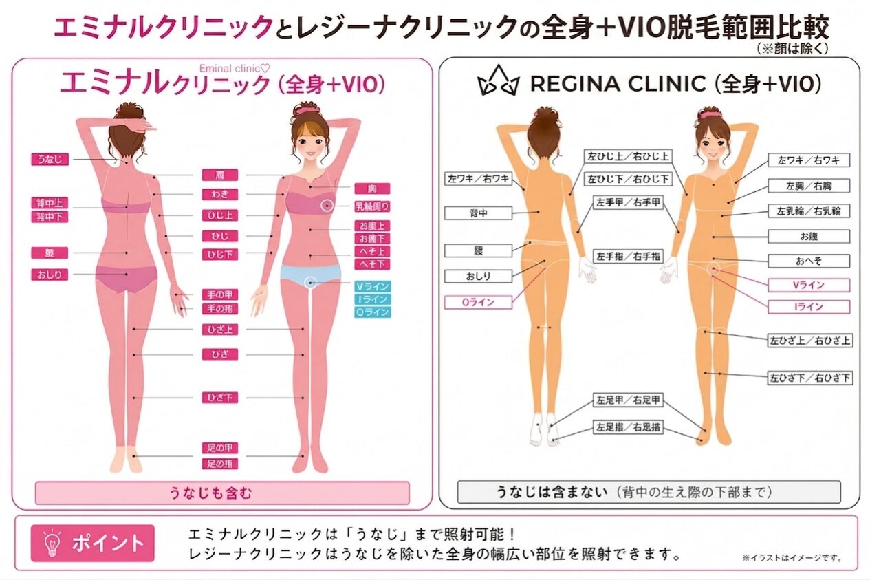 エミナルクリニックとレジーナクリニック脱毛範囲比較(全身+VIO脱毛)